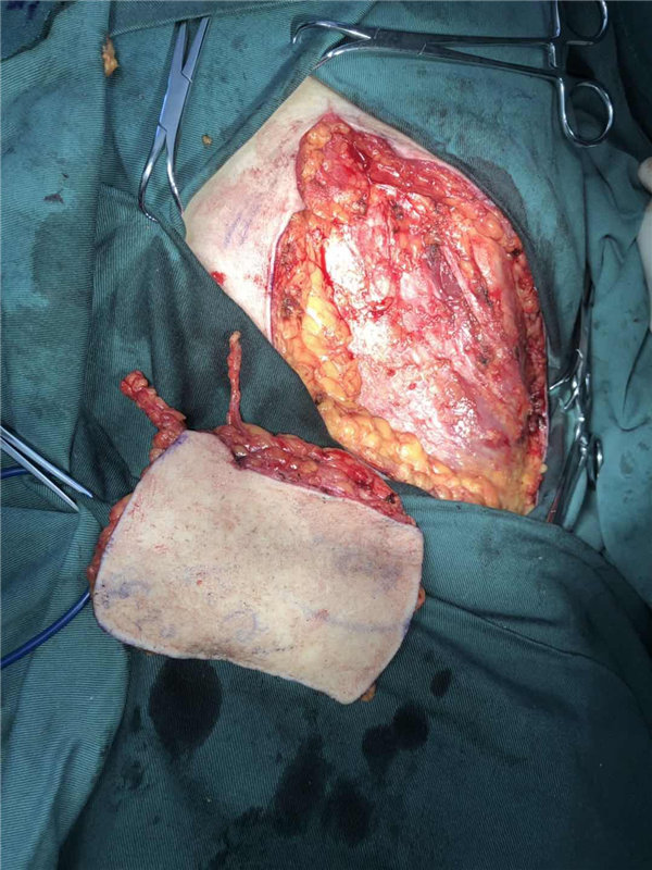 1686020000535119.jpg 193.jpg