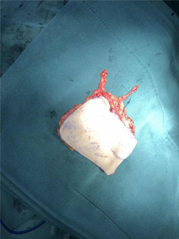 1686020029493479.jpg 194.jpg